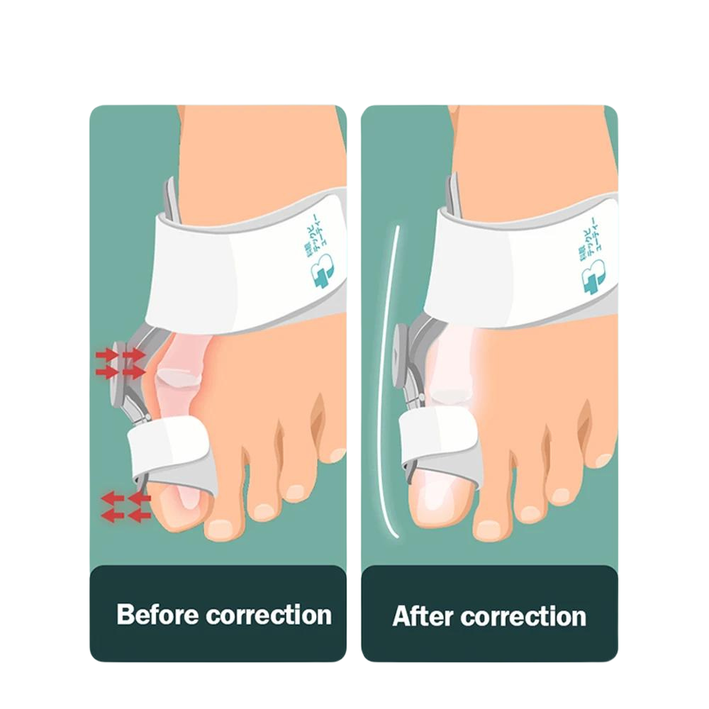Corrector de Juanete – TJ-608